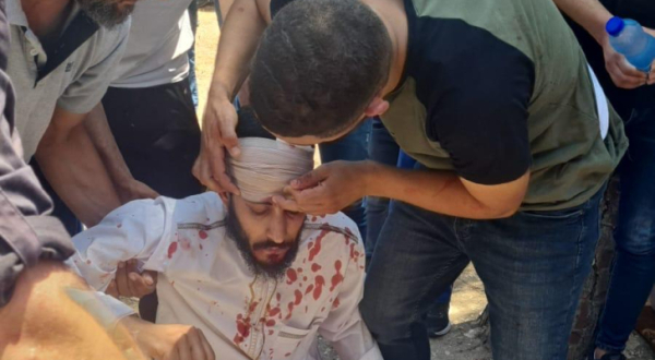 إصابات بين المصلين في الأقصى باعتداء قوات الاحتلال